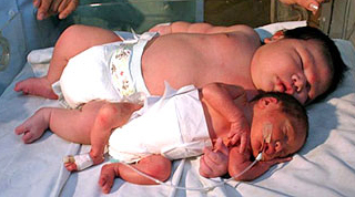 сравнение новорожденных 1