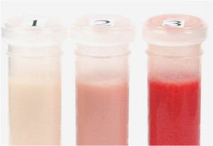 Источник http://www.nature.com/jp/journal/v29/n2/fig_tab/jp2008188f1.html