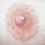 пузырек на соске