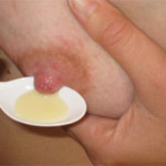 ручное сцеживание 1