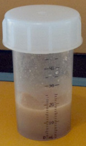 синдром ржавых труб